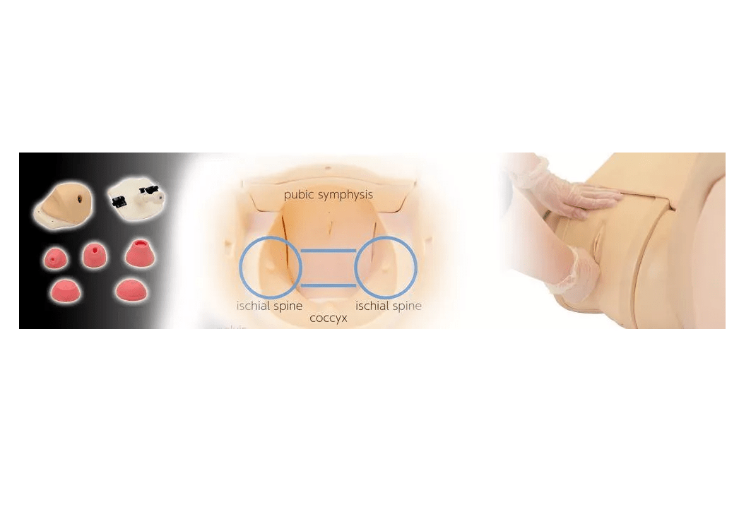 Modul für Hana - Muttermund - Untersuchung - Erler - Zimmer